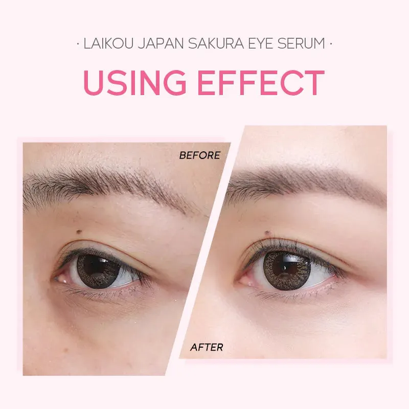 12607 1b-04-17 Serum para ojos 1 Unidad